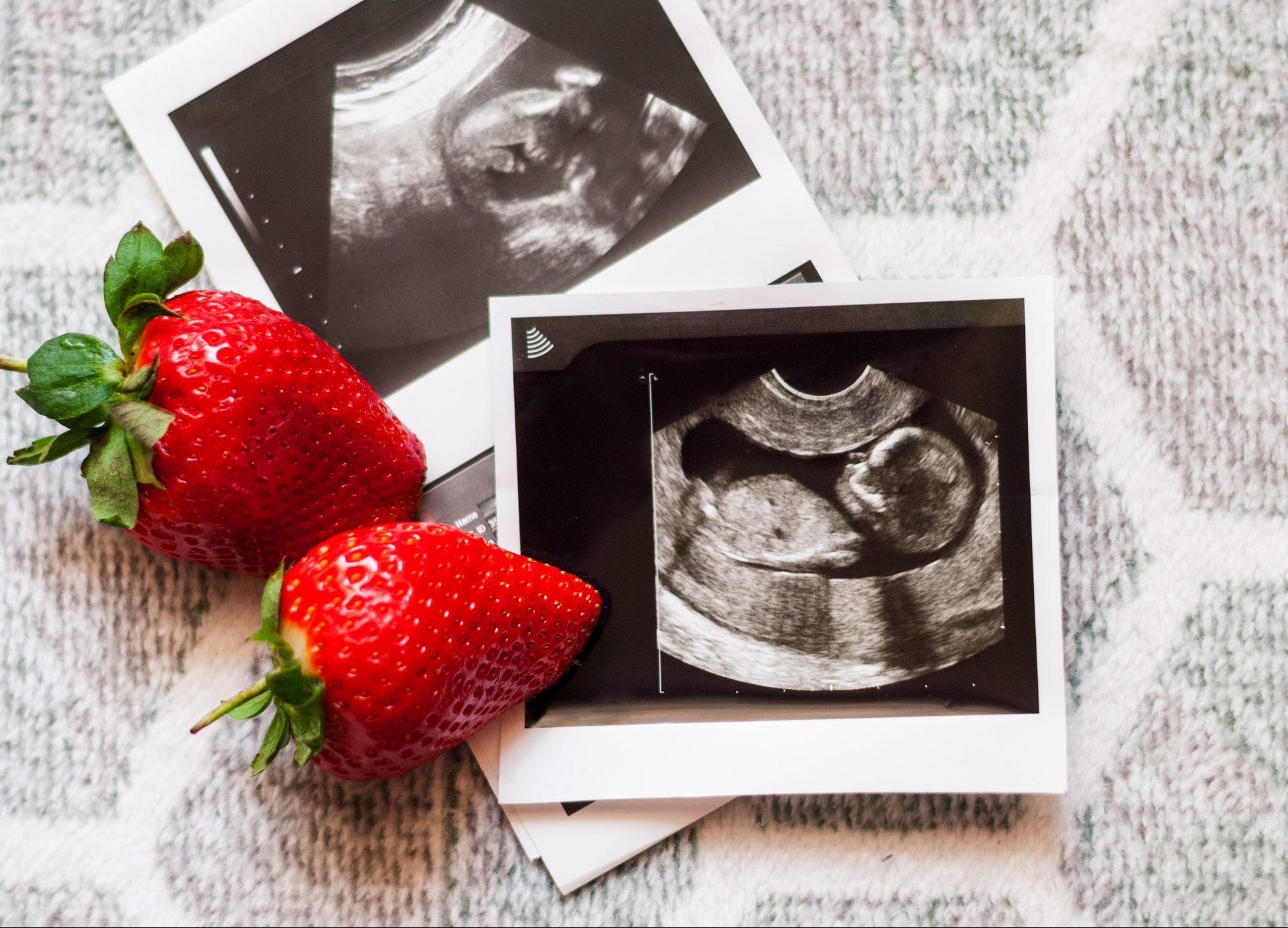 FUNIBER-two-strawberry-and-a-photo-of-a-human-fetus-from-an-ultrasound-scan-during-pregnancy-on-a-gray-background